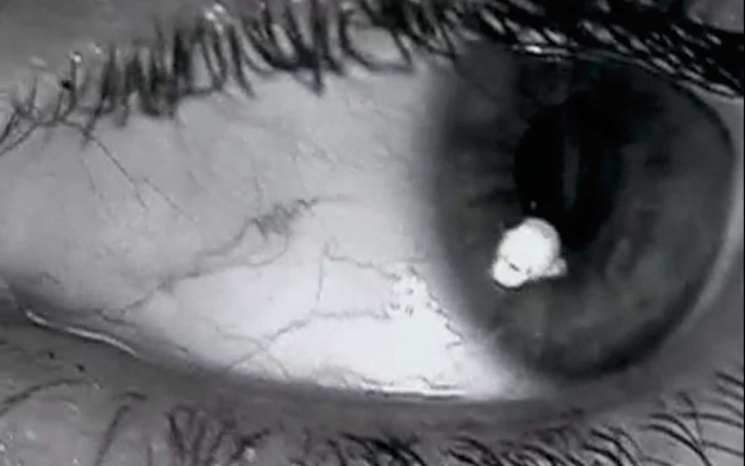 Humains | Yeux
